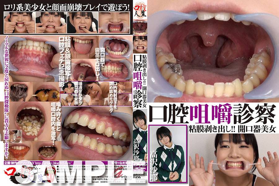 口腔咀嚼診察 粘膜剥き出し!!開口器美女 高沢沙耶　パッケージ画像