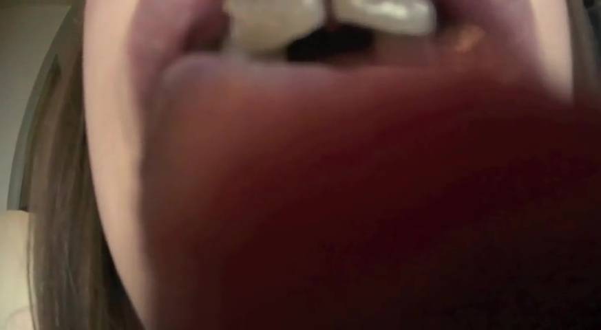 鼻フック&開口器 唾ダラ穴剥け歯列矯正娘　サンプル画像07