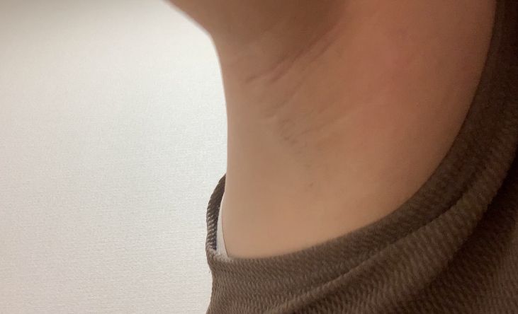 普通の女の子の脇毛抜き-スマホ自撮り◎あんな(26歳)OL　サンプル画像02