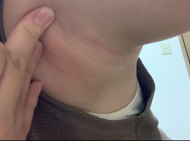 普通の女の子の脇毛抜き-スマホ自撮り◎あんな(26歳)OL　サンプル画像03