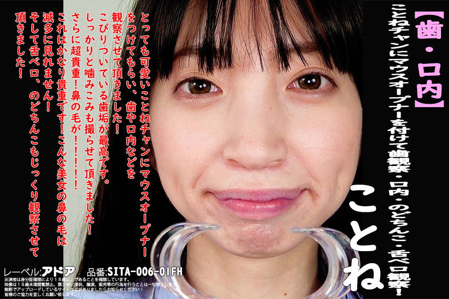 【HD】【歯・口内】大人気美女ことねチャンのマウスオープナーを付けて歯観察・口内・のどちんこ・舌ベロ観察!ことね　パッケージ画像