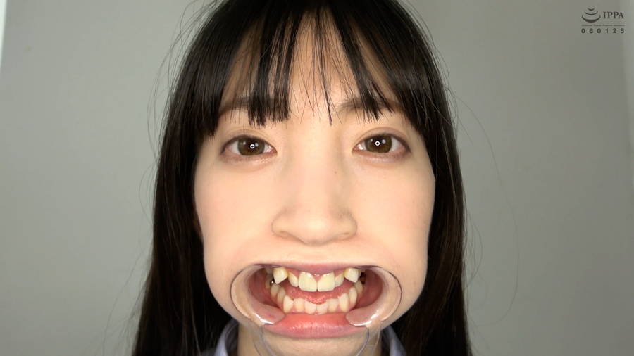 【HD】【歯・口内】大人気美女ことねチャンのマウスオープナーを付けて歯観察・口内・のどちんこ・舌ベロ観察!ことね　サンプル画像01