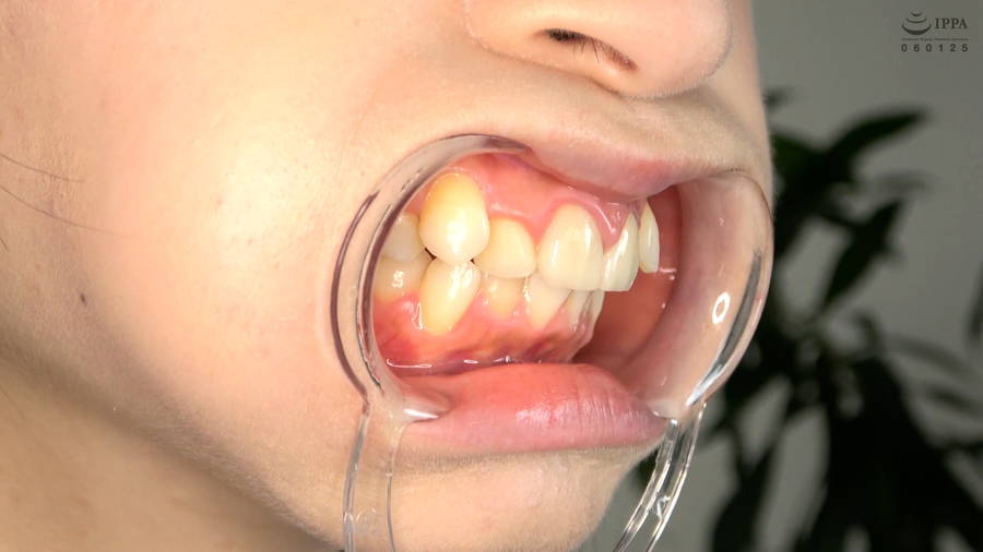 【HD】【歯・口内】大人気美女ことねチャンのマウスオープナーを付けて歯観察・口内・のどちんこ・舌ベロ観察!ことね　サンプル画像03