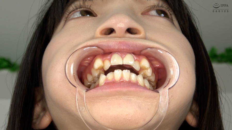 【HD】【歯・口内】大人気美女ことねチャンのマウスオープナーを付けて歯観察・口内・のどちんこ・舌ベロ観察!ことね　サンプル画像05