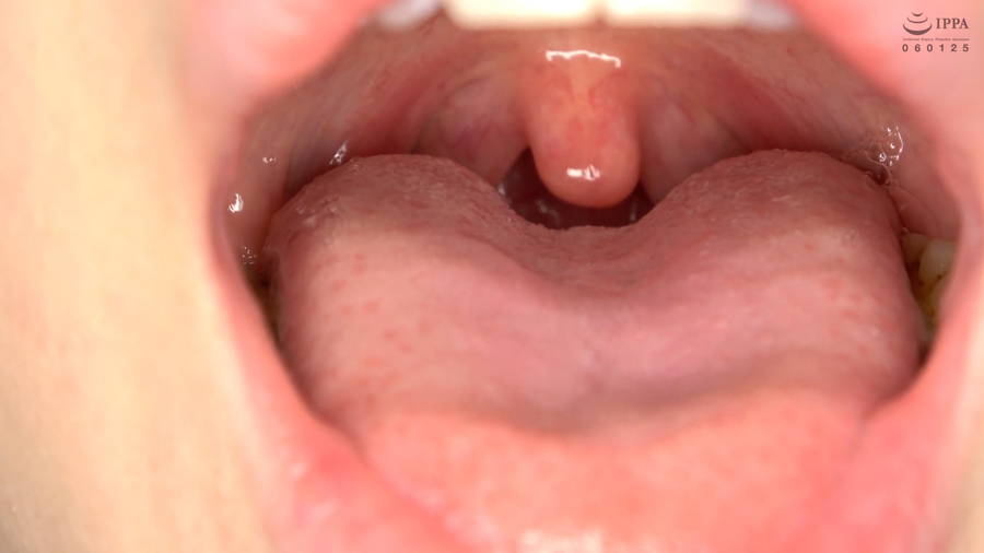 【HD】【歯・口内】大人気美女ことねチャンのマウスオープナーを付けて歯観察・口内・のどちんこ・舌ベロ観察!ことね　サンプル画像07