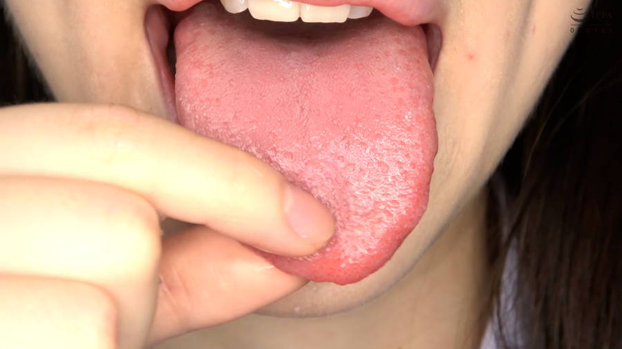 【HD】【歯・口内】大人気美女ことねチャンのマウスオープナーを付けて歯観察・口内・のどちんこ・舌ベロ観察!ことね　サンプル画像09