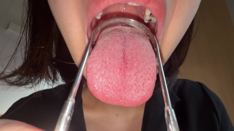 【HD】【個人撮影】湊波流の舌ブラシで「汚舌苔」採取! サンプル画像06