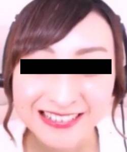 プレミア★ノーズＸＸ　高嶺の鼻すっぴん編 サンプル画像