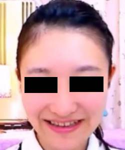 プレミア★ノーズＸＸ　奈落アイドルすっぴん編　 サンプル画像