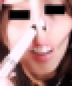 プレミア★ノーズXX 鼻毛ジャングル処理実行 サンプル画像