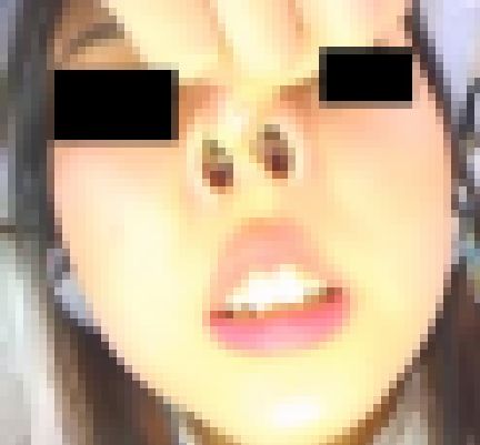 プレミア★ノーズＸＸ　アナと鼻の女王 サンプル画像