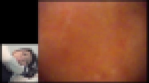 【FetishJapan】肛門科腸内映像 アナル診察 #008 SFJ5-087-08　サンプル画像2