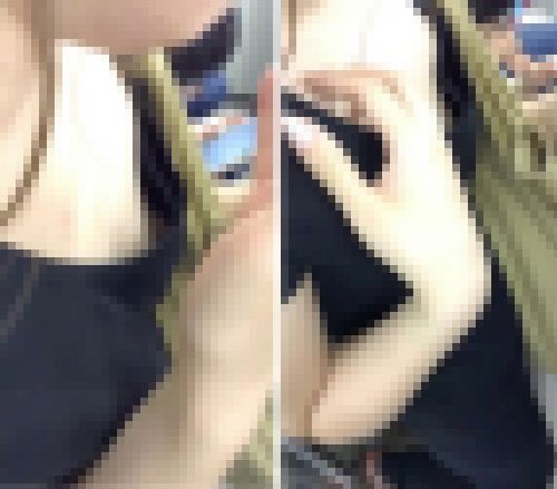 パイン12　サンプル画像2