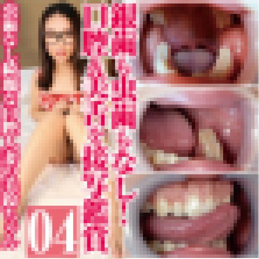 めがねっ子美人妻・美鈴の銀歯も虫歯もなし!口腔&美舌開口器接写 サンプル画像
