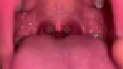 喉姫 1人目 [FBOM-00009]　サンプル画像1