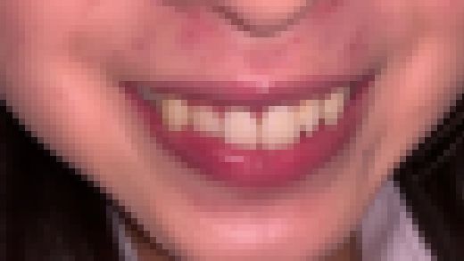 歯姫 6人目 [FBOM-00015]　サンプル画像2