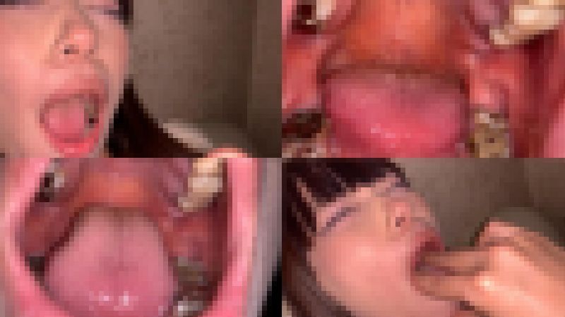 歯姫 9人目 [FBOM-00026] サンプル画像