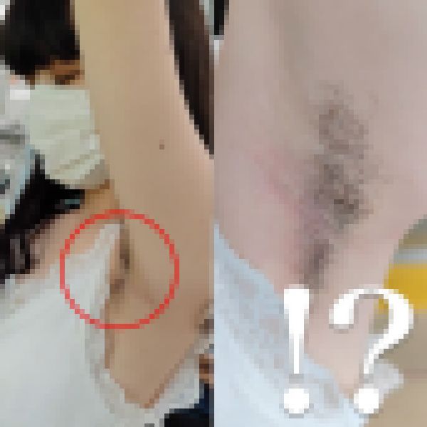 【腋毛超接写】ちょ、、、え？？？ サンプル画像