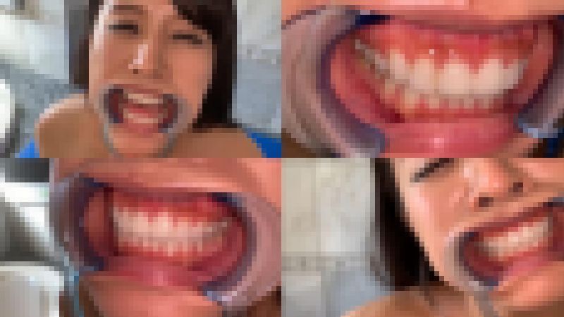 歯姫 14人目 [FBOM-00043] サンプル画像