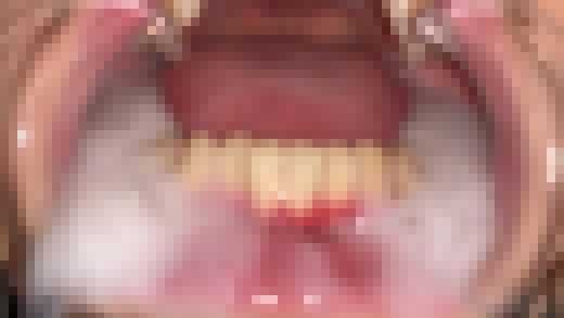 歯姫 22人目 [FBOM-00063]　サンプル画像3