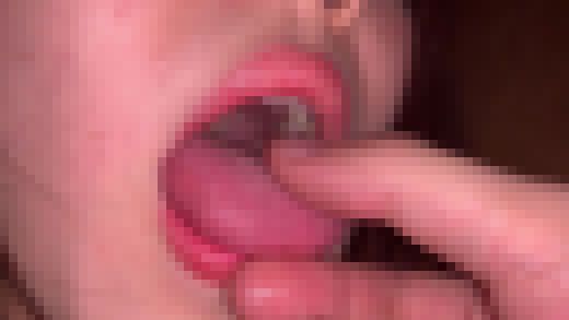 口腔②　サンプル画像1