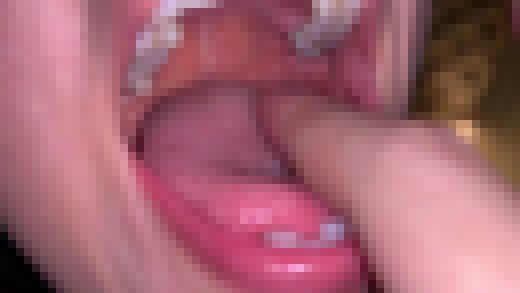 口腔②　サンプル画像3