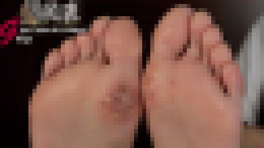 アパレル店員みさきの撮影直前に大怪我！傷だらけの24cm足裏足指接写　サンプル画像1