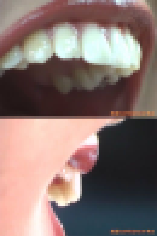 【HD】綺麗なお姉さまのお口事情[20020501]　サンプル画像1