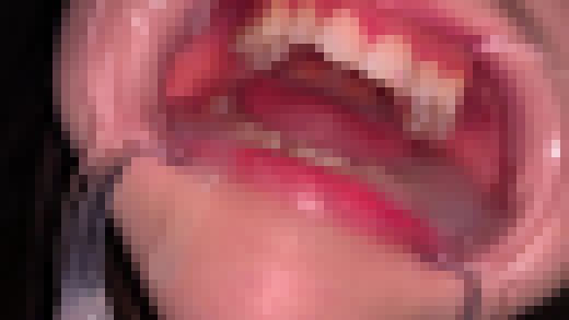 歯姫 29人目 [FBOM-00079]　サンプル画像3