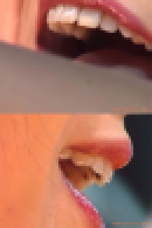 【HD】綺麗なお姉さまのお口事情[20030102]　サンプル画像1