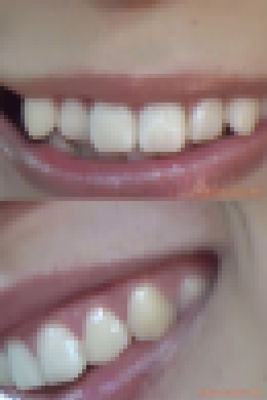 【HD】綺麗なお姉さまのお口事情[20030102]　サンプル画像3