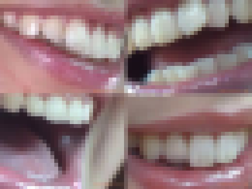 【お得なSET販売】綺麗なお姉さまのお口事情[20030100] サンプル画像