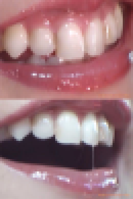 【お得なSET販売】綺麗なお姉さまのお口事情[20040100]　サンプル画像1