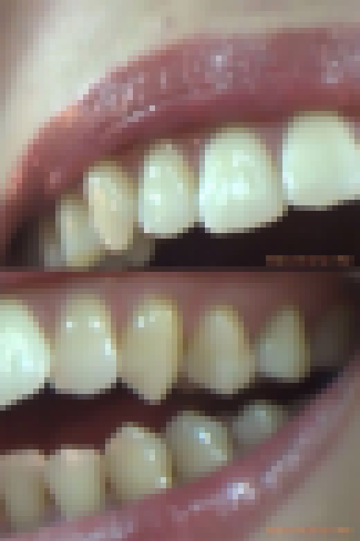 【お得なSET販売】綺麗なお姉さまのお口事情[20040100]　サンプル画像2