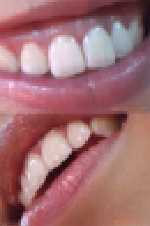 【お得なSET販売】綺麗なお姉さまのお口事情[20040100]　サンプル画像3