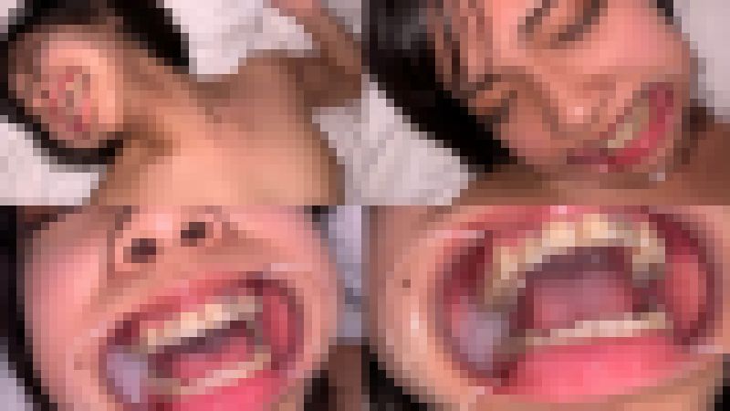 歯姫 40人目 [FBOM-00098] サンプル画像