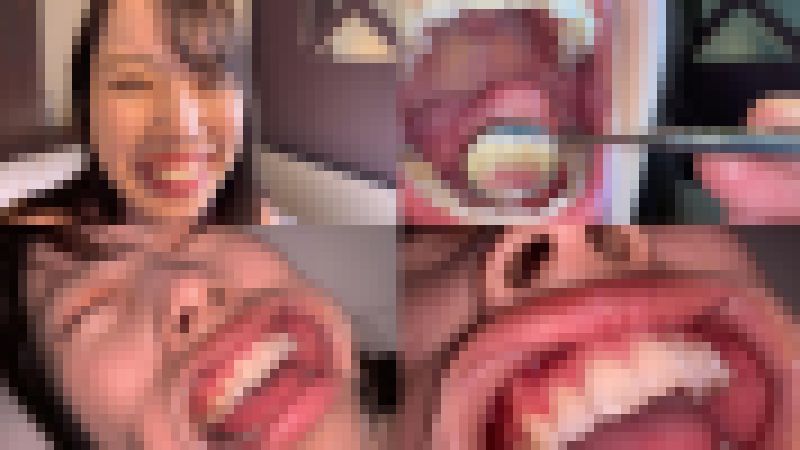 歯姫 42人目 [FBOM-00100] サンプル画像