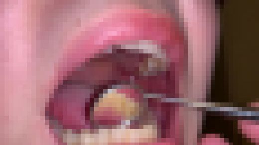 歯姫 49人目 [FBOM-00112]　サンプル画像2