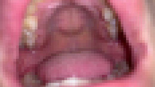 歯姫 49人目 [FBOM-00112]　サンプル画像3