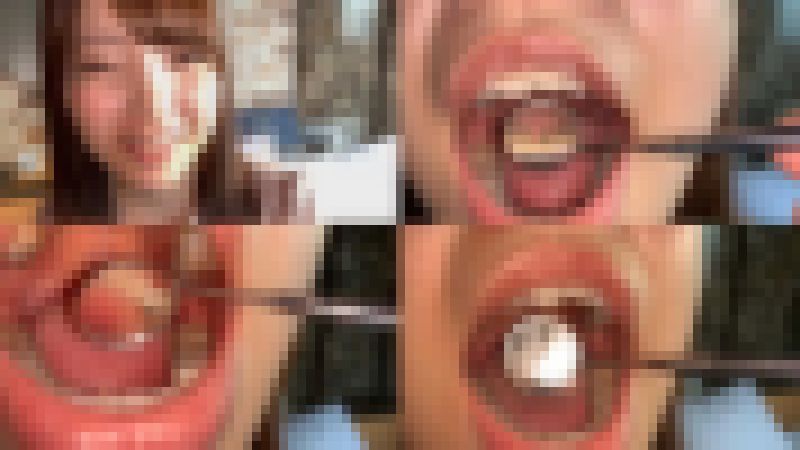 歯姫 52人目 [FBOM-00119] サンプル画像