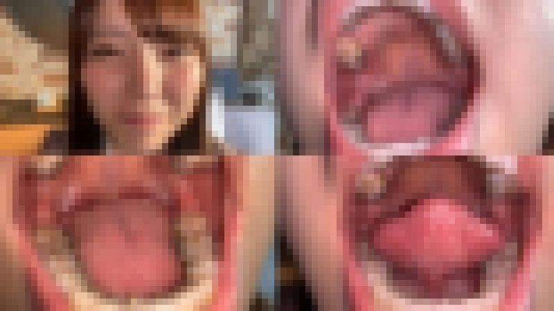 歯姫 53人目 [FBOM-00120] サンプル画像