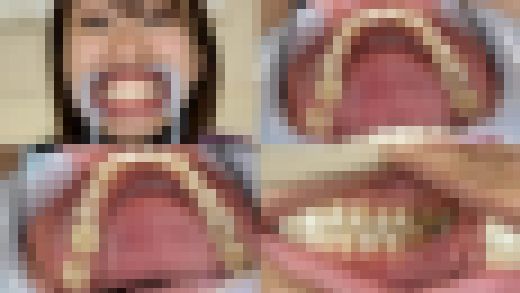 【歯フェチ】美波ももちゃんの歯を観察しました！　サンプル画像1