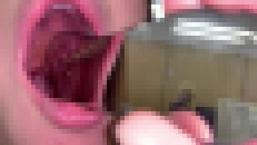 歯姫 58人目 [FBOM-00131]　サンプル画像1