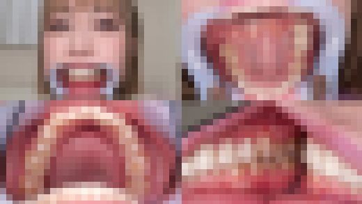 【歯フェチ】川菜美鈴ちゃんの歯を観察しました！　サンプル画像1