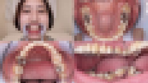 【歯フェチ】佐々木咲和ちゃんの歯を観察しました！　サンプル画像1