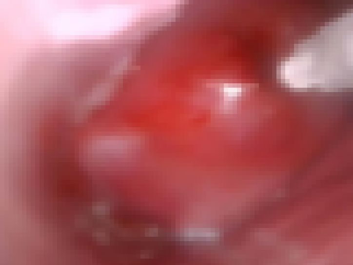 【マニア・フェチ】クスコ/子宮口/シリンジ サンプル画像