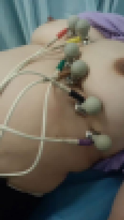 熟女の上半身診察中(3)　サンプル画像1