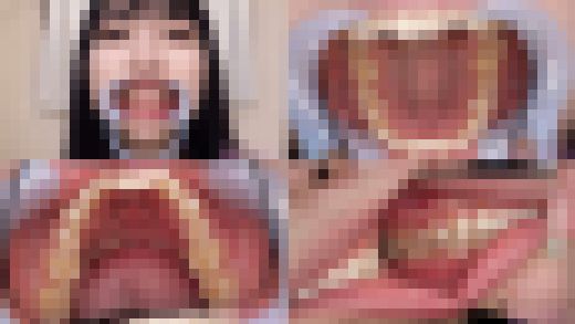 【歯フェチ】涼花くるみちゃんの歯を観察しました! サンプル画像1