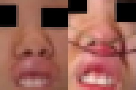 プレミア★ノーズＸＸ　崩しきって私も興奮します激顔編 サンプル画像