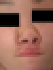 プレミア★ノーズＸＸ　崩しきって私も興奮します激顔編　サンプル画像1